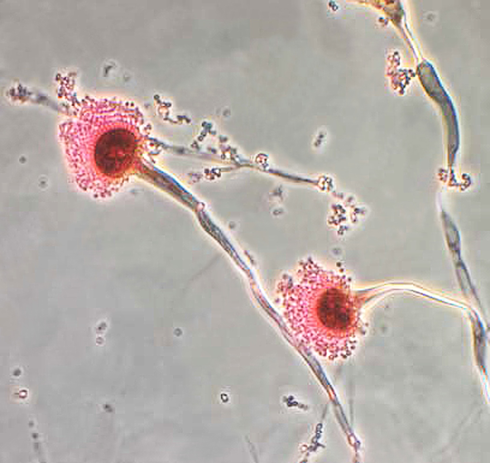 Image of A. fumigatus