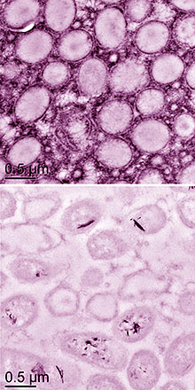 Biofilm images