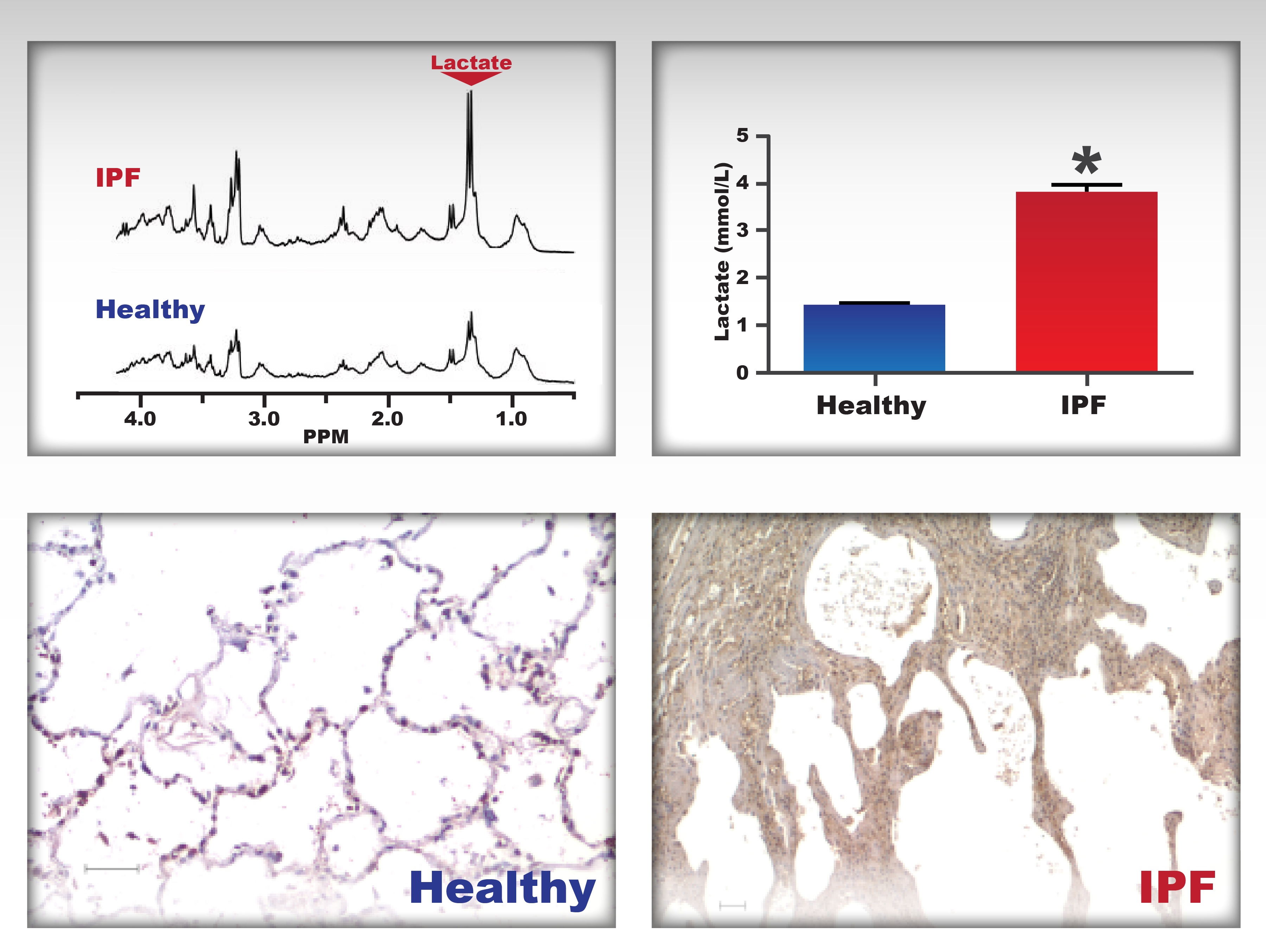 images of lung tissue