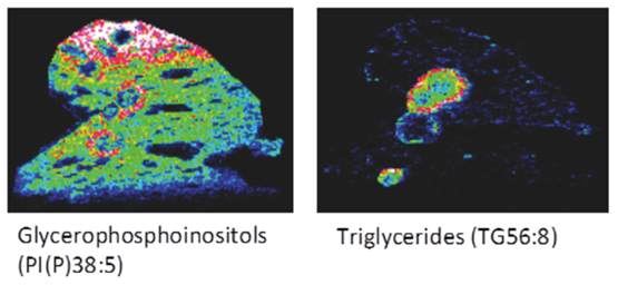 Lipid images