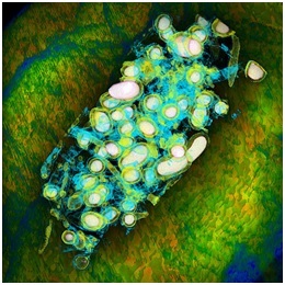 Microbial community
