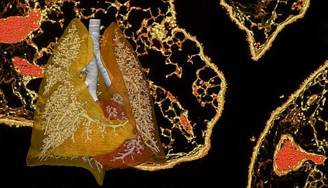 lung tissue