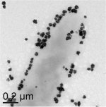 Electron Micrograph