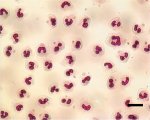 neutrophils