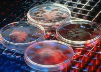 Petri Dishes