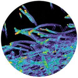 Soybean Root Hairs