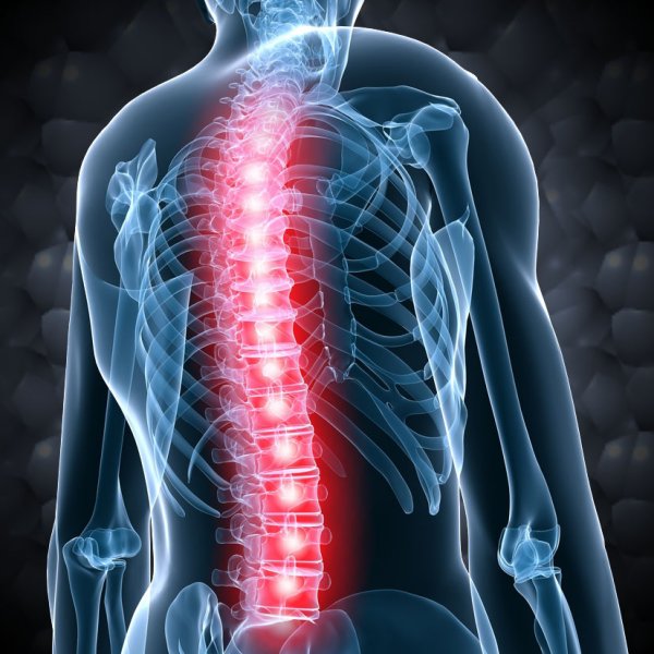 spinal fluid