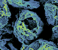 False colored micrograph