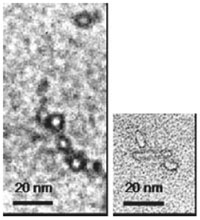 SENs on electron microscopic images 