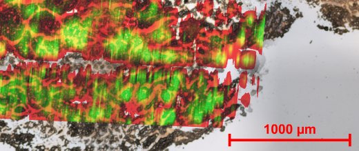 Human Tissue Layers