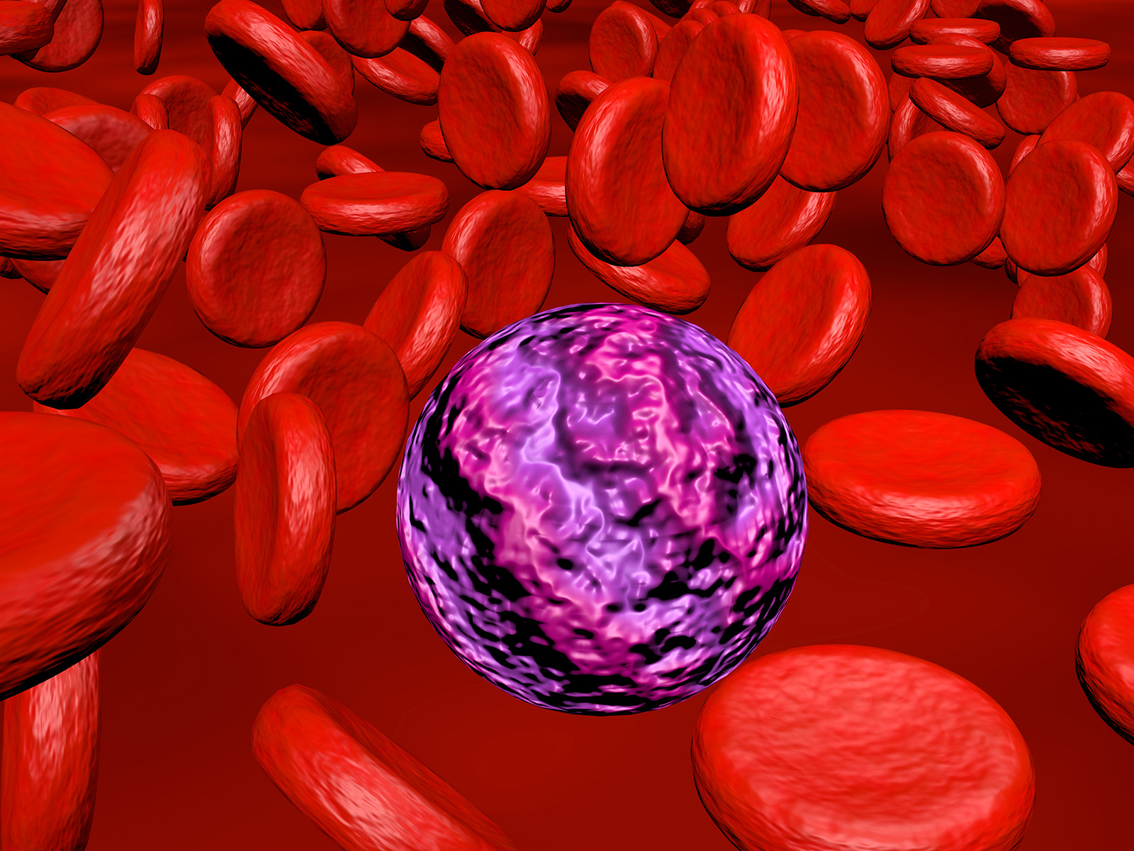 Illustration of blood cells in acute myeloid leukemia