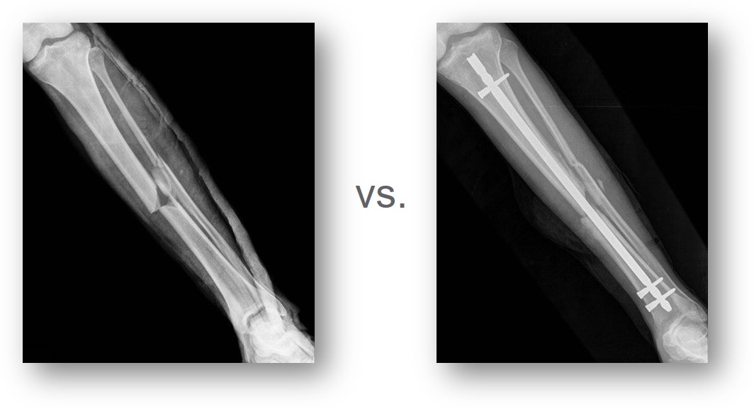 Pre-operation and post-operation X-rays 