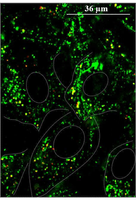 Black background with green dots showing nanoparticles in a cell.