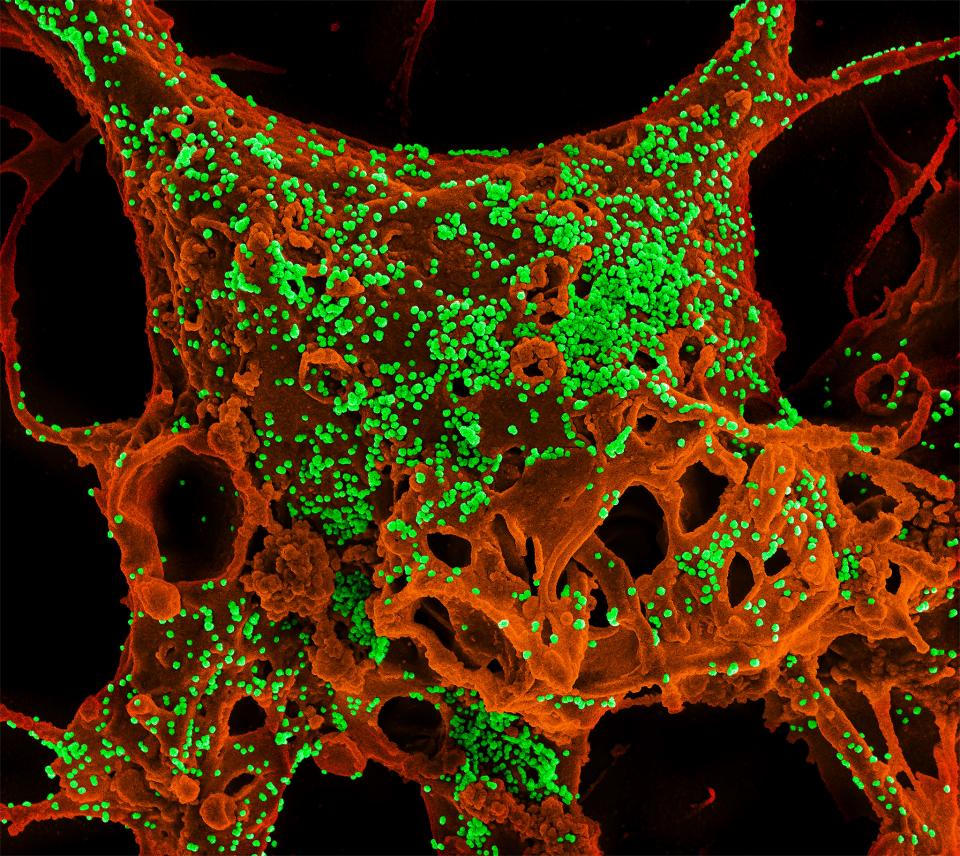 MERS cell