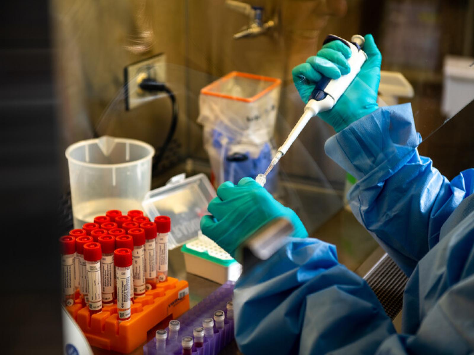 Image of hands pipetting 