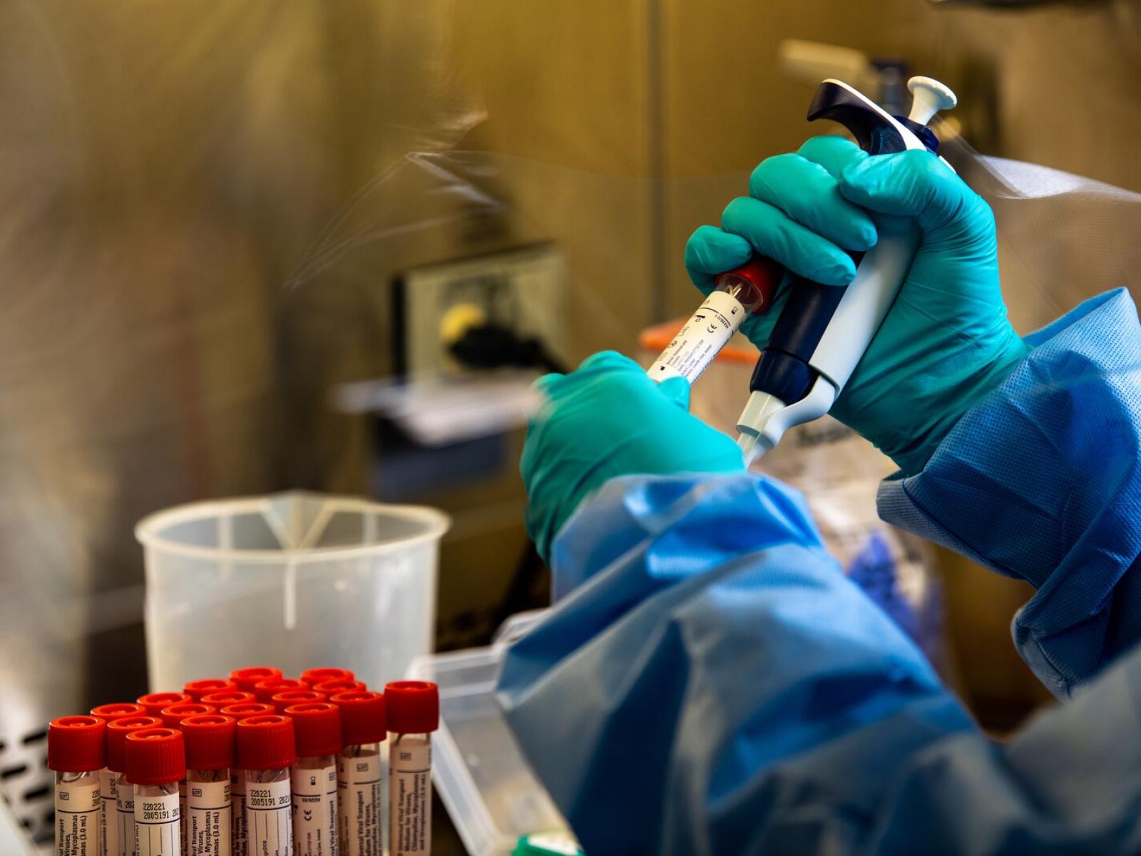 In the ongoing mission to curb the impact of coronaviruses, PNNL’s PERK Inhibitor Coronavirus Treatment may help reduce mortality in infected patients.