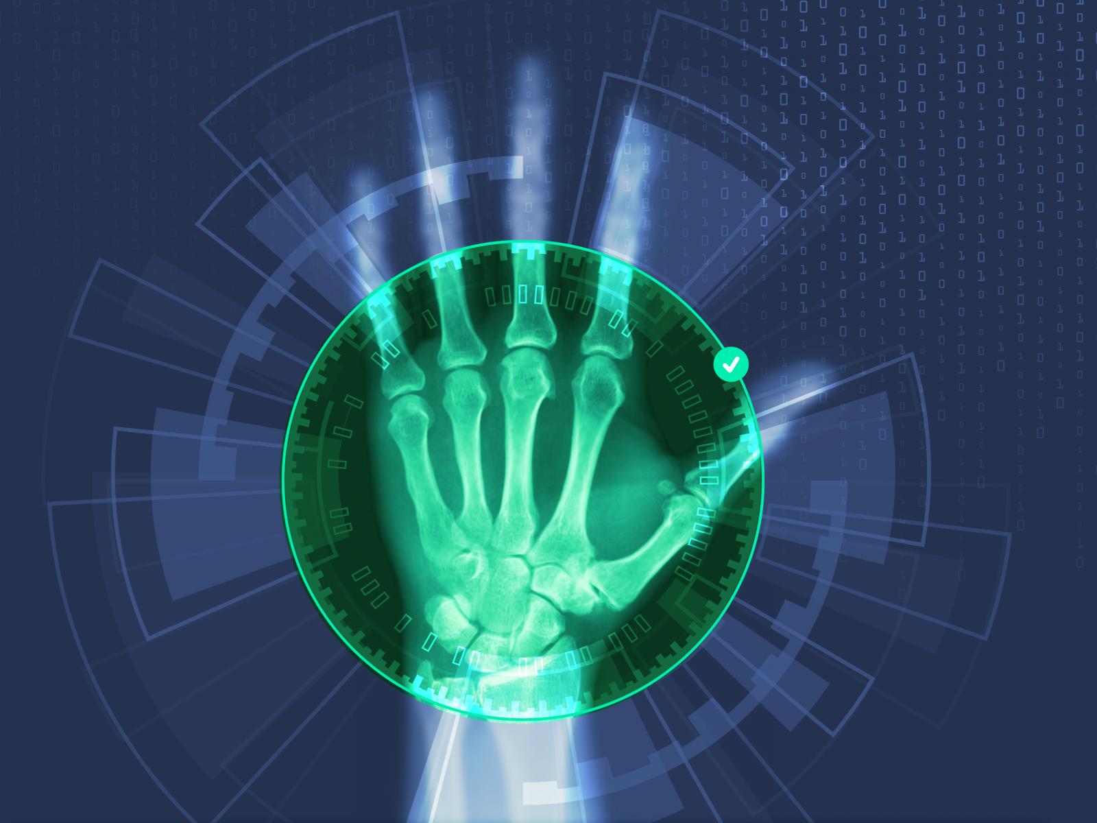 Artistic Hand X-Ray