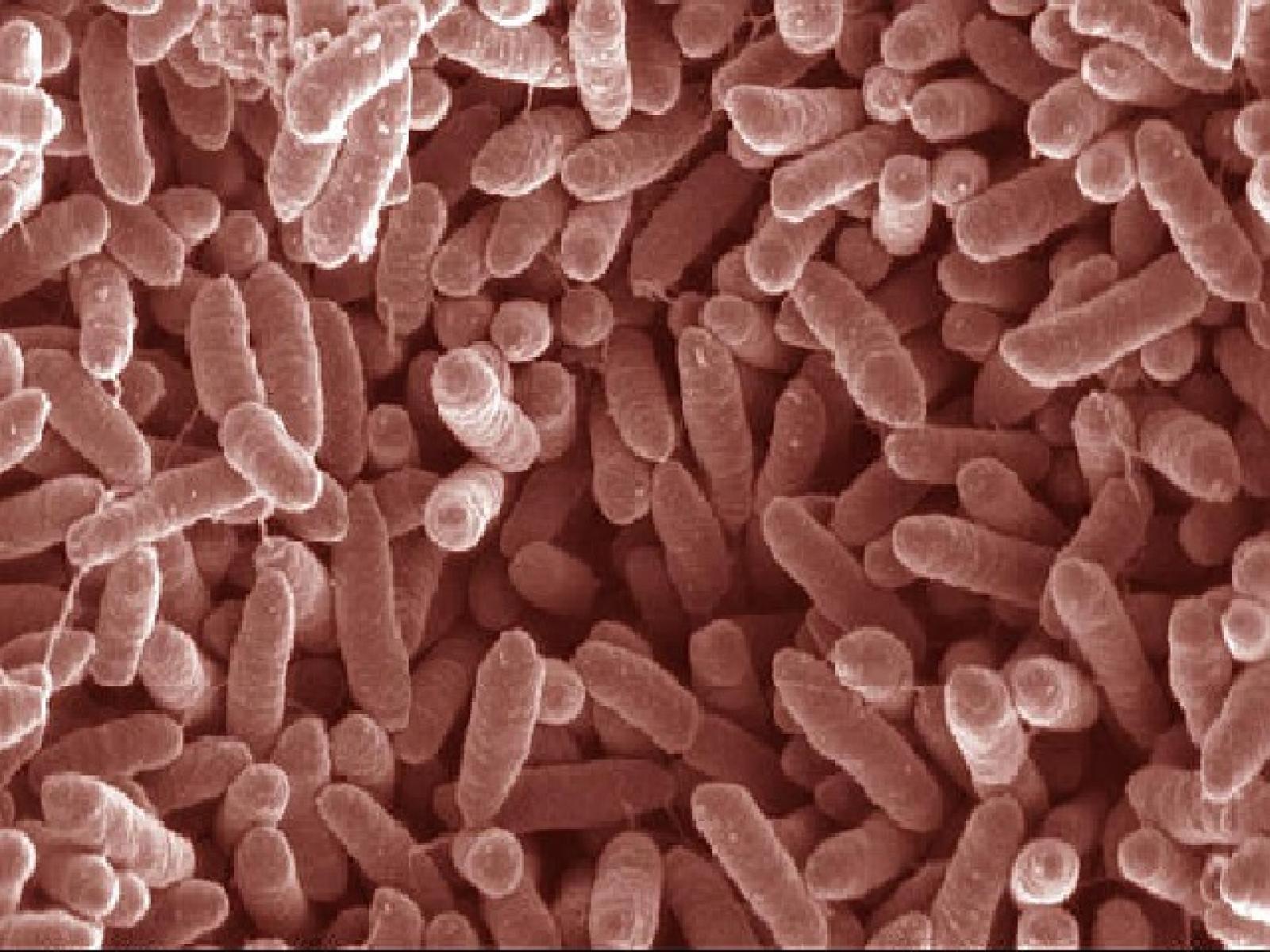 Microscope image of microbes