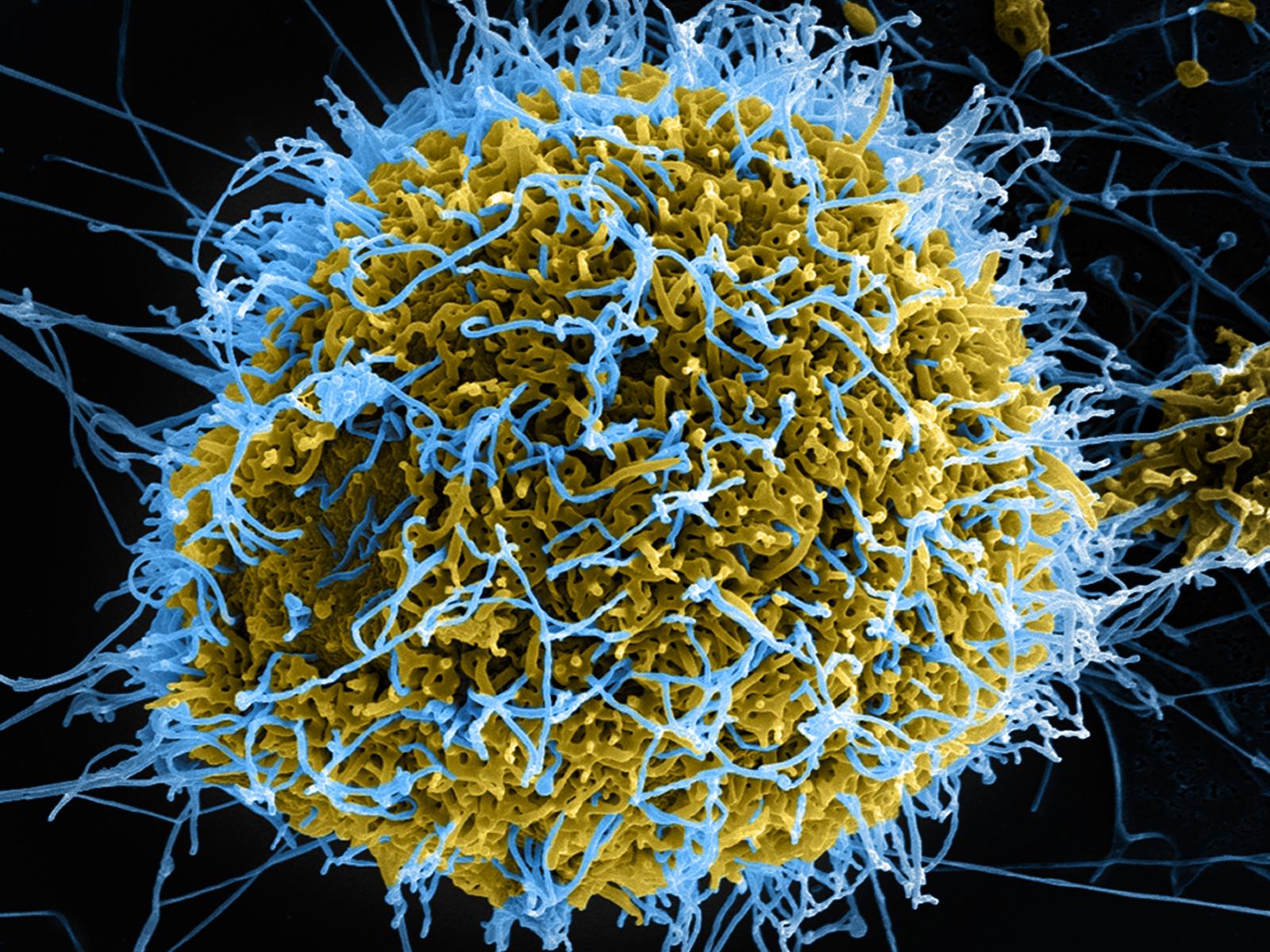 Colorized scanning electron micrograph of filamentous Ebola virus particles (blue) budding from a chronically infected VERO E6 cell (yellow-green).
