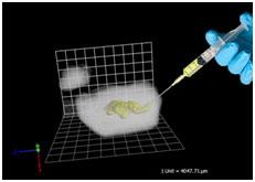 This new non-toxic injectable radiogel technology delivers insoluble yttrium-90—a well-established medical radioisotope with many applications in cancer treatment—to a precise location for targeted radiation therapy.