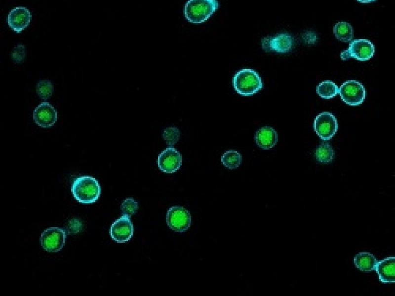 Using the patented process, Lipomyces starkeyi cells (shown here with large lipid bodies stained green, surrounded by their cell wall stained blue) can be engineered to create various oil and chemical products.