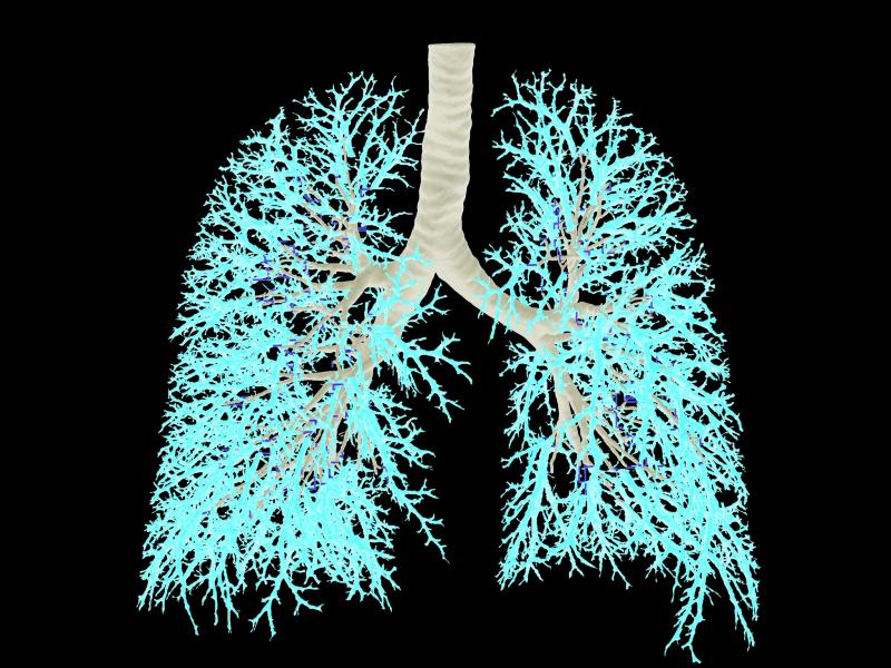 PNNL researchers are part of a national team creating a map of molecules in the lungs.