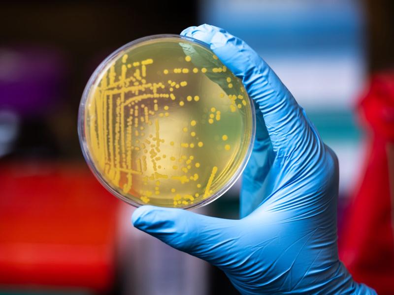 Photograph of a bacterial plate sample being held by a researcher