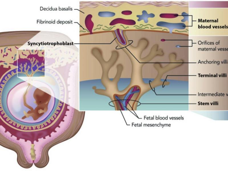The placental regions of importance in normal pregnancies and those associated with complications. The maternal blood vessels, basal plate, terminal villi, stem villi, chorionic plate, and syncytiotrophoblast regions are all bolded in this figure to illustrate their importance in pregnancy complications.
