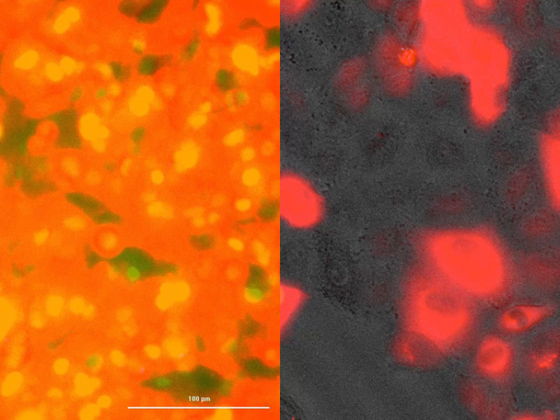 In OminScreen, cells glow if a pathogen is present.