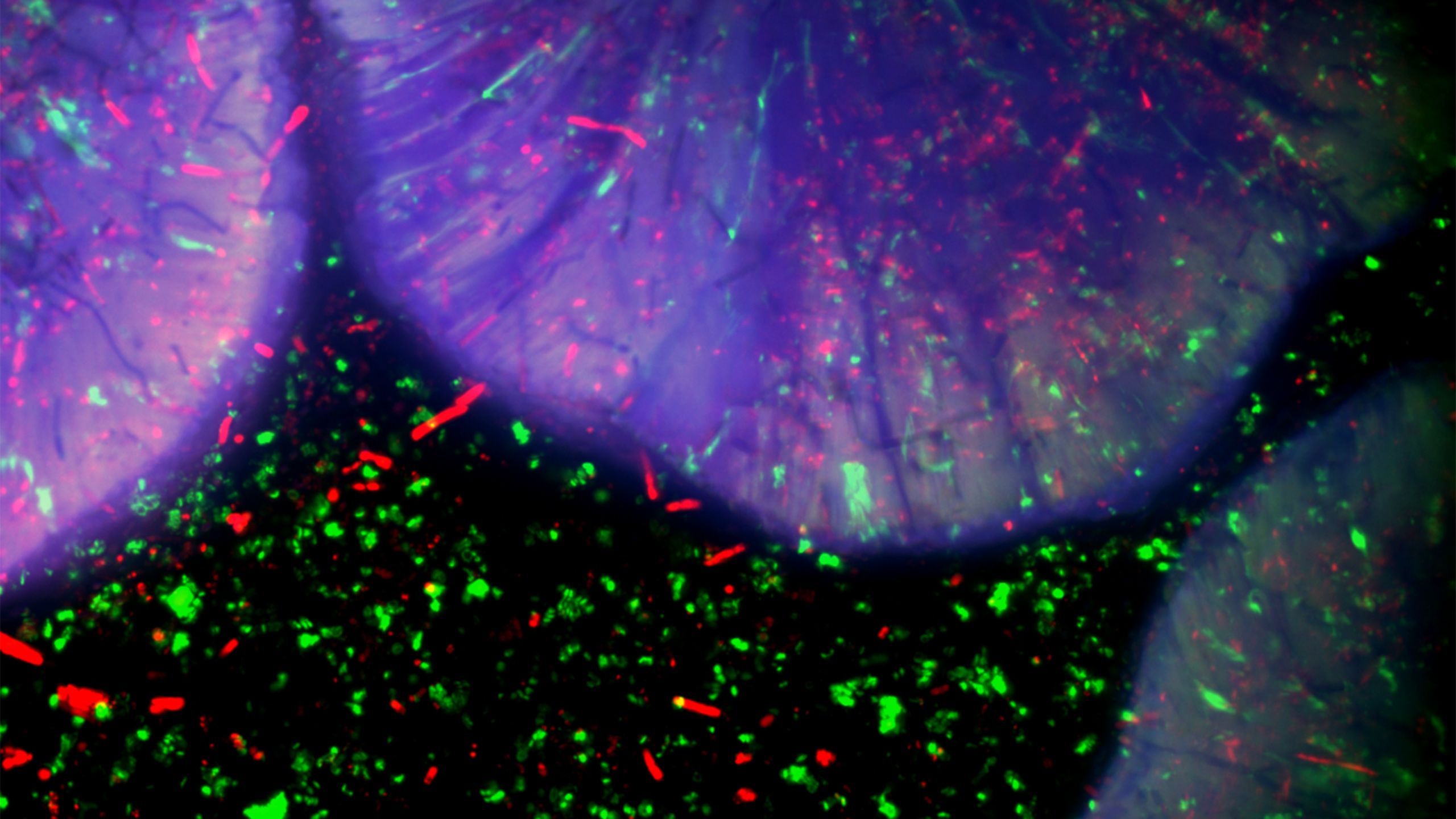 close-up image of microbes under a microscope